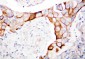Anti-CD18 Antibody